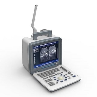 Digital Portable Ultrasound Scanner, Medical Devices Supplier, Medical Devices Supplier in Pakistan, Hospital Furniture Supplier, Polycare Diagnostics